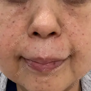 メディアージュクリニック de IMAGEクリニック恵比寿口コミ