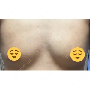 銀座マイアミ美容外科口コミ