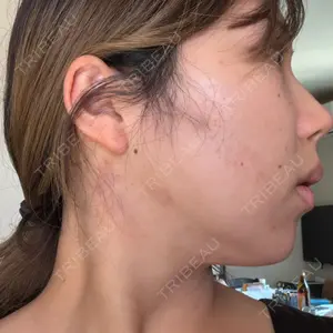 ビラビューティークリニック 小倉美容外科/美容皮膚科 ビラビューティークリニック口コミ