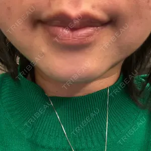 APスキンクリニック銀座口コミ