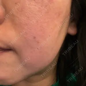 APスキンクリニック銀座口コミ