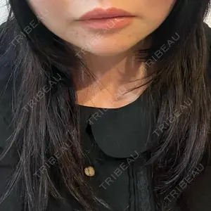 ルラ美容クリニック ルラ美容クリニック 広島院口コミ