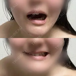 HAAB CLINIC HAAB×DREAM BEAUTY CLINIC 東京本院口コミ