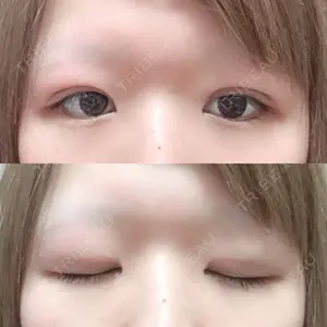 湘南美容クリニック 湘南美容クリニック 松山院口コミ