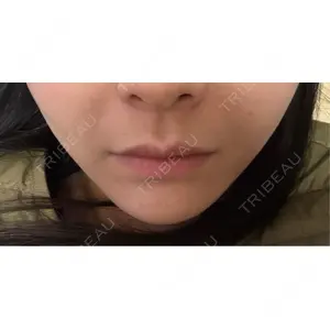 白金ビークリニック 本院口コミ