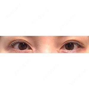 プリモ麻布十番クリニック口コミ