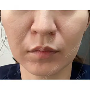 美容皮膚科ティファクリニック 美容皮膚科ティファクリニック 横浜院口コミ