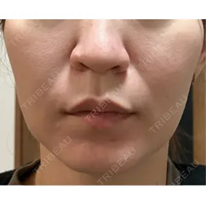 美容皮膚科ティファクリニック 美容皮膚科ティファクリニック 横浜院口コミ