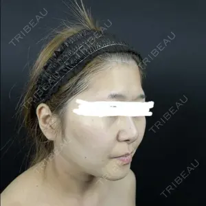 藤・ナチュレ美容クリニック 藤・ナチュレ美容クリニック 銀座院口コミ