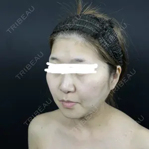 藤・ナチュレ美容クリニック 藤・ナチュレ美容クリニック 銀座院口コミ