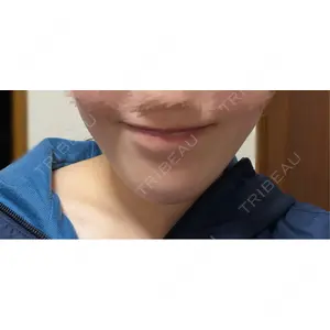Belle Via Clinicの