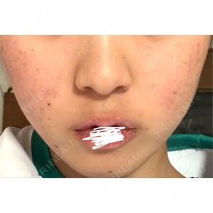 BITO BEAUTY CLINIC BITO BEAUTY CLINIC口コミ