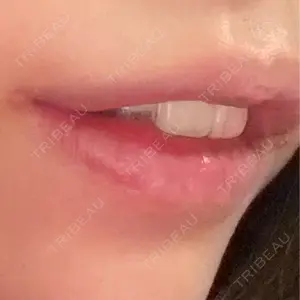 口コミ