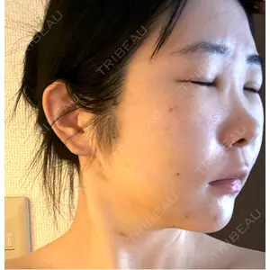 BLINC CLINIC （ブリンク クリニック）口コミ