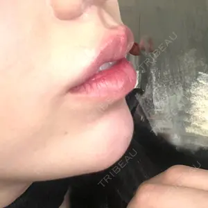 L‘amour clinic Tokyo【ラムールクリニック東京】口コミ