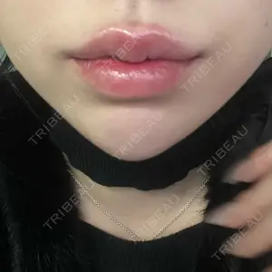 L‘amour clinic Tokyo【ラムールクリニック東京】口コミ