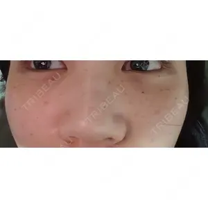 やさしい美容皮膚科・皮フ科 やさしい美容皮膚科・皮フ科　秋葉原院口コミ