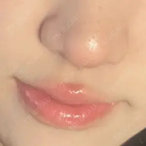 HAAB CLINIC HAAB×DREAM BEAUTY CLINIC 大阪梅田院口コミ