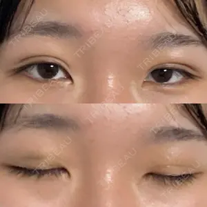 湘南美容クリニック 湘南美容クリニック 千葉センシティ院口コミ
