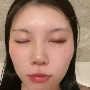 口コミ