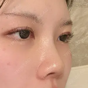 口コミ