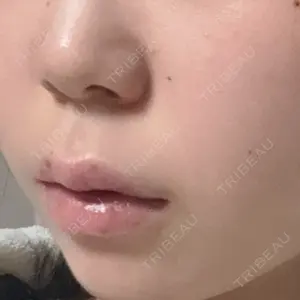 HAAB CLINIC HAAB×DREAM BEAUTY CLINIC 東京本院口コミ