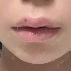 HAAB CLINIC HAAB×DREAM BEAUTY CLINIC 東京本院口コミ