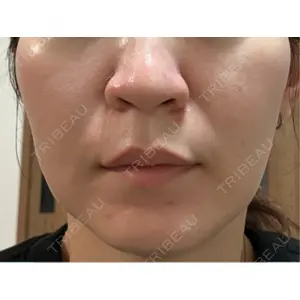 美容皮膚科ティファクリニック 美容皮膚科ティファクリニック 横浜院口コミ
