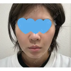 口コミ