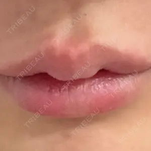口コミ