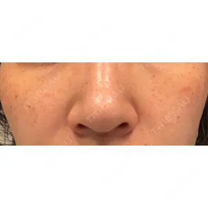 CIEL SKIN CLINIC（シエルスキンクリニック）口コミ