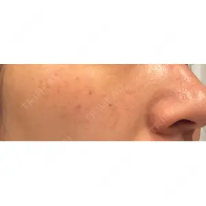 CIEL SKIN CLINIC（シエルスキンクリニック）口コミ