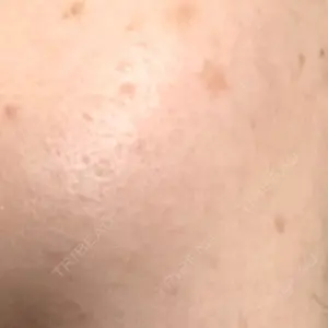 ルラ美容クリニック ルラ美容クリニック 千葉院 / ルラスキンクリニック 千葉院口コミ