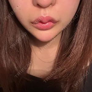 口コミ