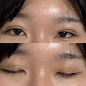 湘南美容クリニック 湘南美容クリニック 千葉センシティ院口コミ