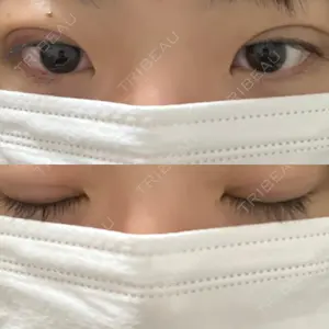 湘南美容クリニック 湘南美容クリニック 千葉センシティ院口コミ