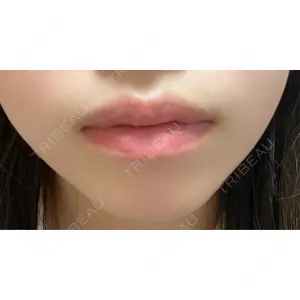 口コミ