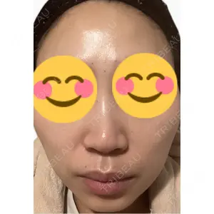 口コミ
