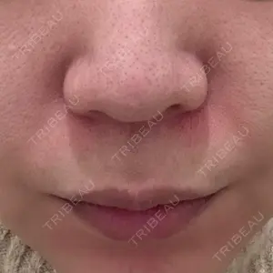 口コミ