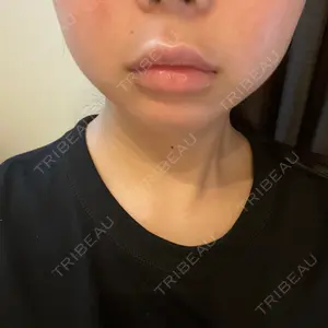HAAB CLINIC HAAB×DREAM BEAUTY CLINIC 東京本院口コミ