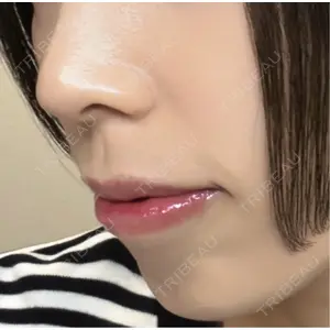 口コミ