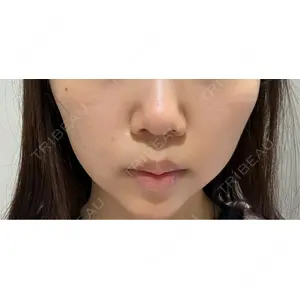 口コミ