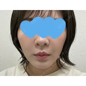 口コミ