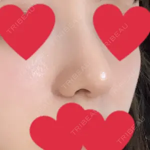 HANABI整形外科口コミ