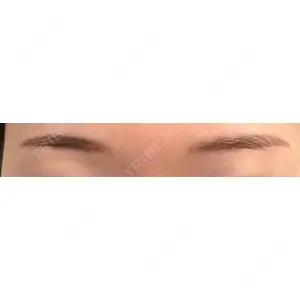 グランジョイクリニック口コミ