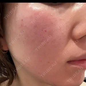 おおかみ美容のクリニック おおかみ美容のクリニック 新宿院口コミ
