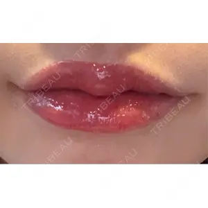 プロクリニック PRO CLINIC プロクリニック 銀座院口コミ