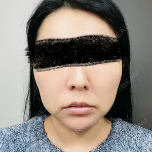 HAAB CLINIC HAAB×DREAM BEAUTY CLINIC 東京本院口コミ