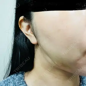 HAAB CLINIC HAAB×DREAM BEAUTY CLINIC 東京本院口コミ