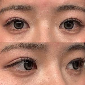 LUHO（ルホ）美容外科口コミ